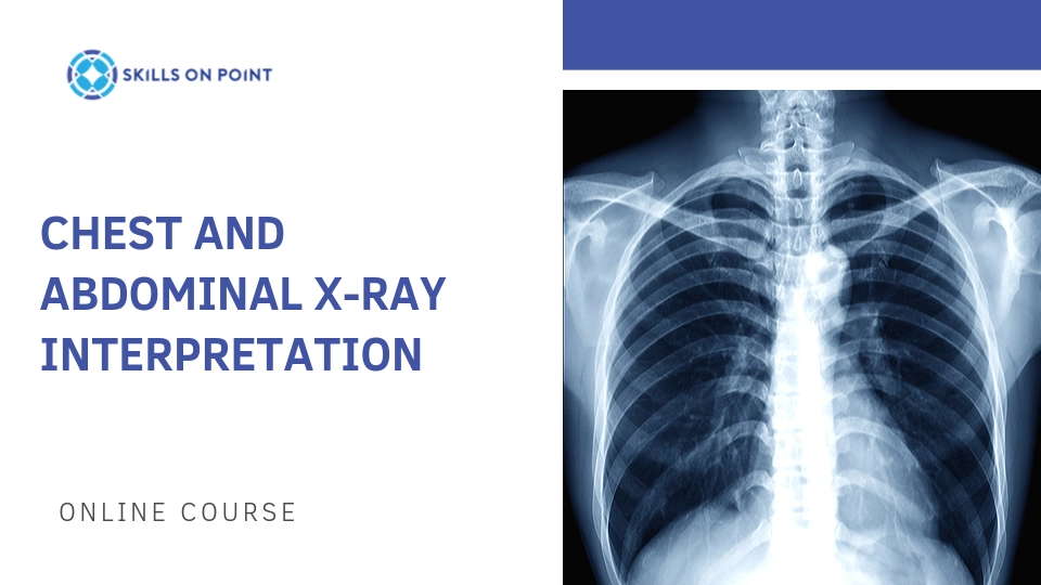 Chest X-Ray Interpretation - Nursing Continuing Education Course