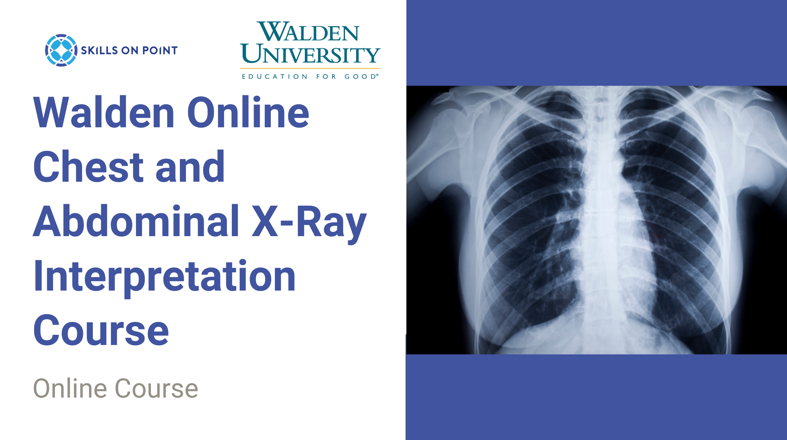 OPTIONAL: Walden Online Chest and Abdominal X-Ray Interpretation Course